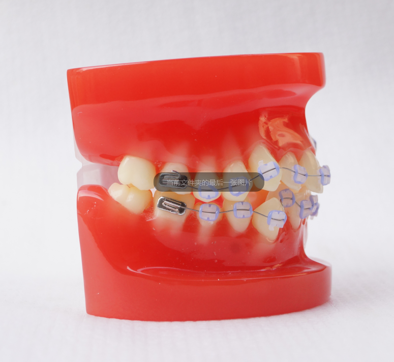 Sino Dental Typodont With Ceramic Braces Teeth Model